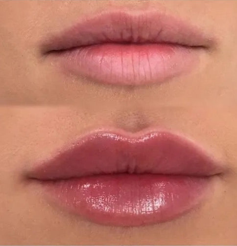 LIP PLUMPER